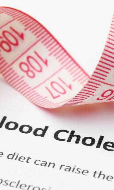 High Cholesterol &#8211; Symptoms and Treatment Options