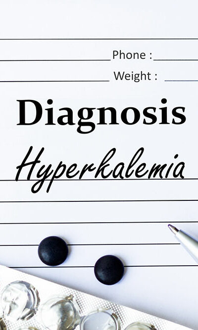 Hyperkalemia &#8211; Symptoms, causes, and treatments