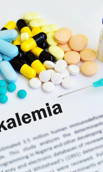 Hypokalemia &#8211; what you should know