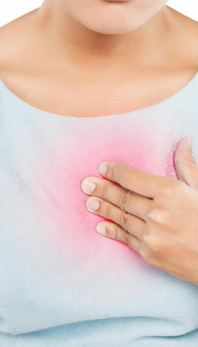 Important Things You Should Know About Heartburn Relief