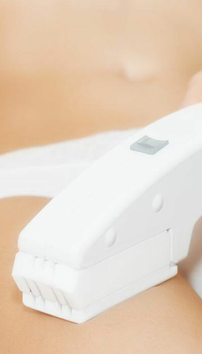 Ingrown Hair Removal And Prevention