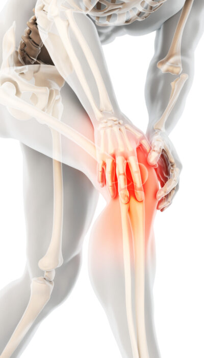 Osteoarthritis And Osteoporosis &#8211; Symptoms, Differences And Treatments