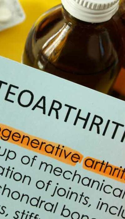 Osteoarthritis: Causes, symptoms, and treatments