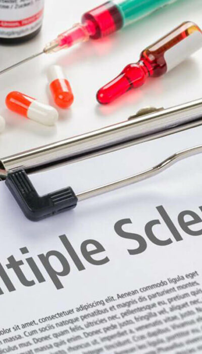 Most Promising New Multiple Sclerosis Treatment Options