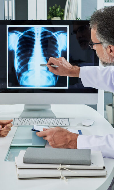 Signs, Symptoms, And Treatment Options For Lung Cancer