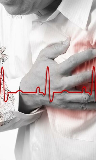 Symptoms And Treatment For Atrial Fibrillation