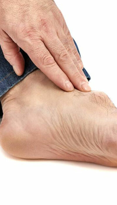 Symptoms, Causes, and Treatment of Gout