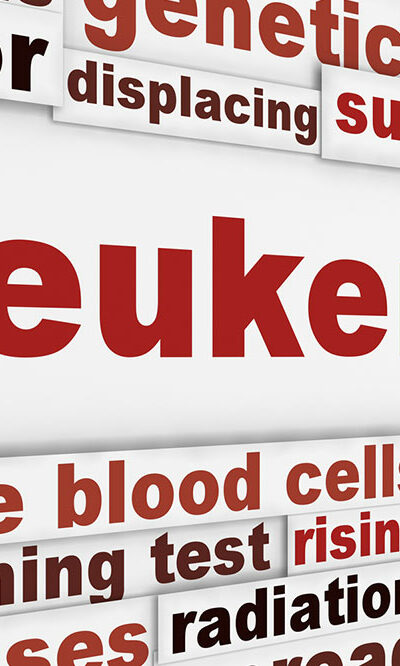 Symptoms, causes, and risk factors of leukemia