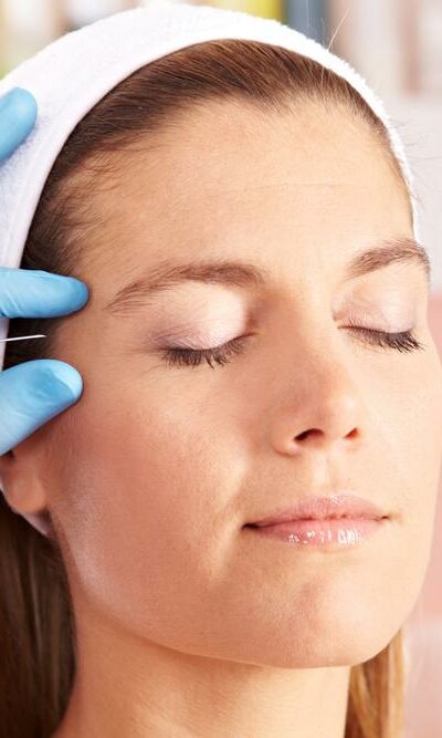 Points to Consider Before Undergoing a Botox Treatment