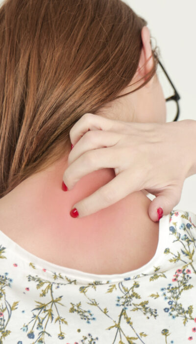 Prevention And Medication For Shingles