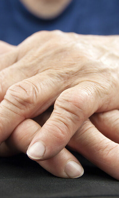 Rheumatoid Arthritis &#8211; Diagnosis and Treatment Options