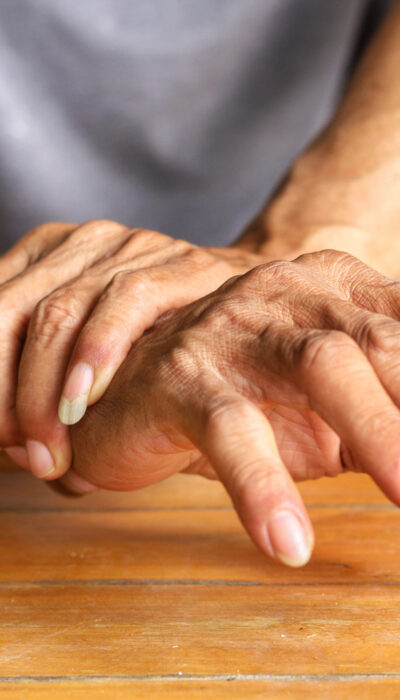 Ways To Manage Psoriatic Arthritis With Lifestyle Changes