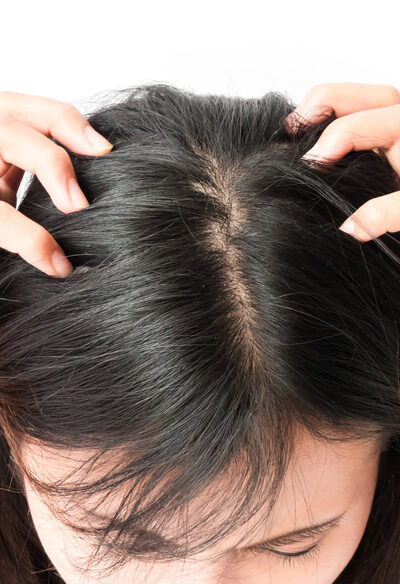 What To Know About Treating An Itchy Scalp