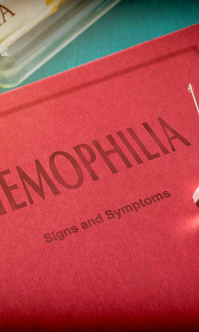 What are the symptoms of hemophilia