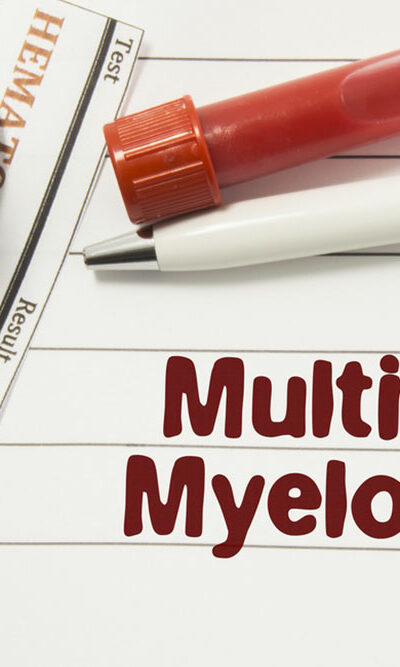 Top 3 foods for multiple myeloma symptoms