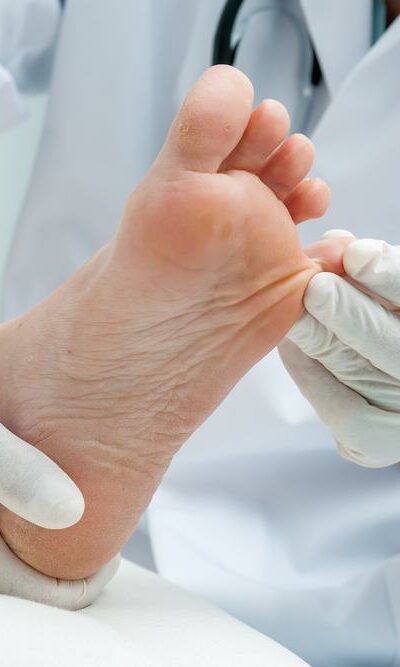 The Best Toenail Fungus Treatment Options For Quick Relief