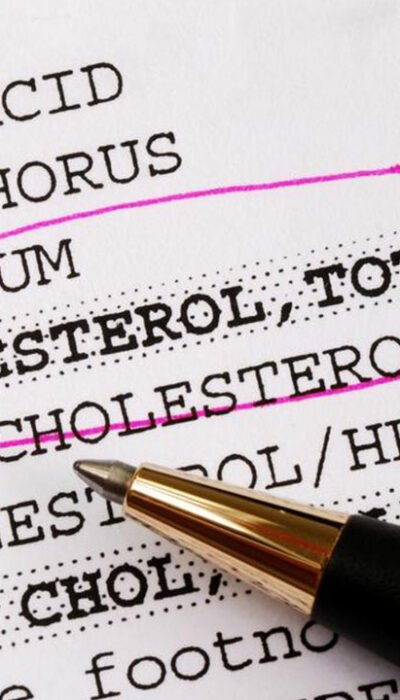 Things You Need To Know About Cholesterol