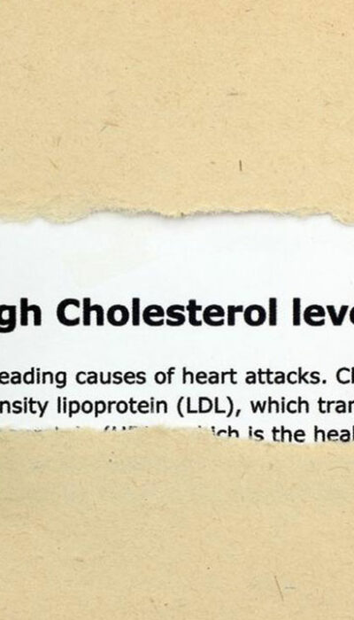 Things You Need to Know about Cholesterol Levels