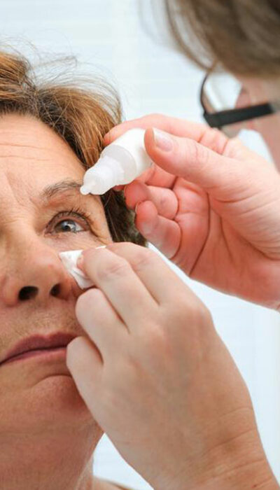 Things You Should Know About Causes of Dry Eyes