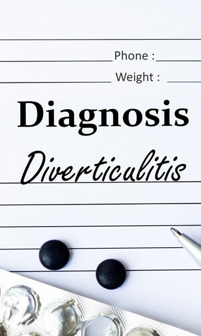 Things to Know about Diverticulitis