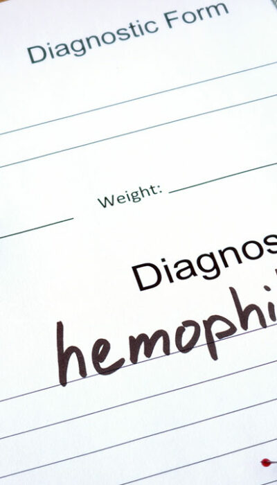 Three Factors to Consider While Living with Hemophilia