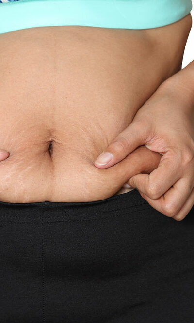 Tips to Lose Stubborn Belly Fat