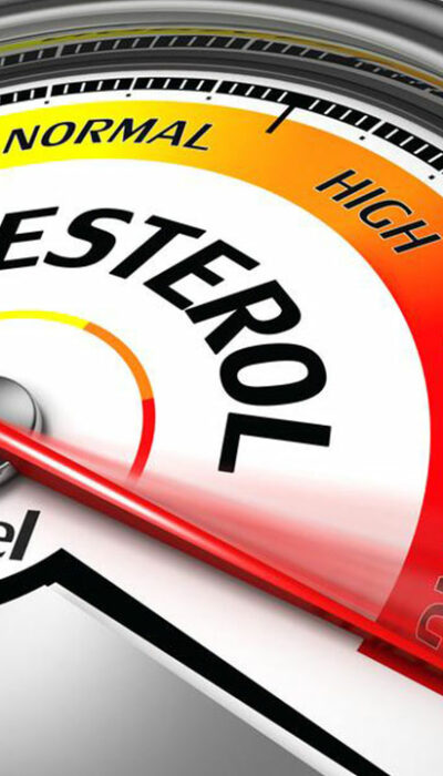 Tips to Manage Your Cholesterol Levels