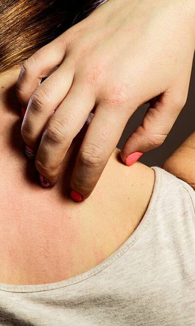 Tips to Treat Pain after Shingles