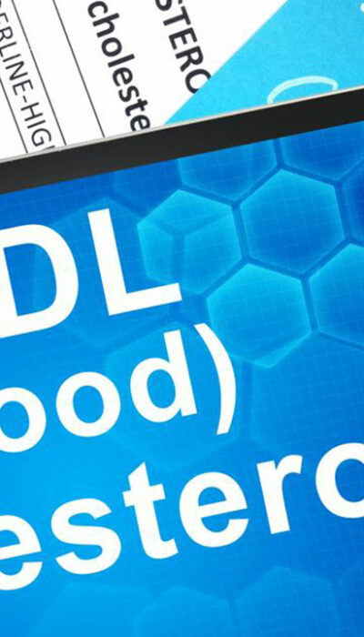 Understanding HDL Cholesterol