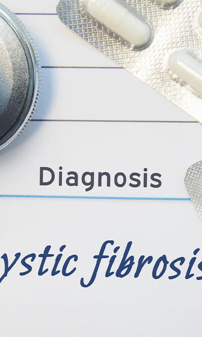 Diagnosis &#038; Treatment of Cystic Fibrosis