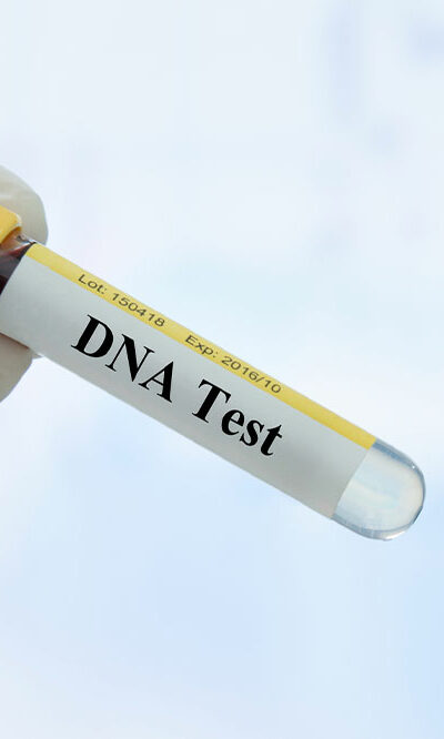 Things to Know Before Taking a DNA Test