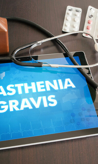 Myasthenia Gravis &#8211; Causes, Symptoms, and Prevention Methods