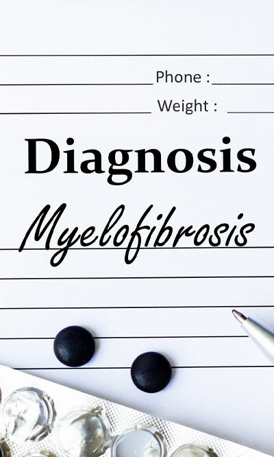 Myelofibrosis &#8211; Symptoms, causes, and management options