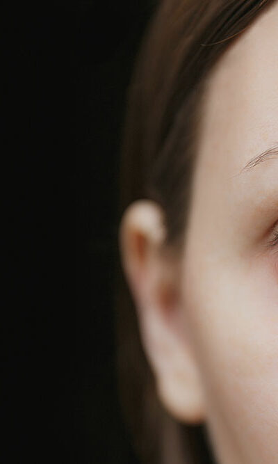 3 Ways to Get Rid of a Chalazion