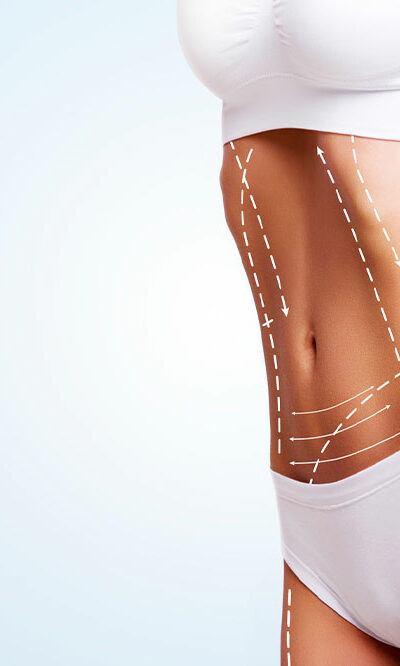 Liposuction &#8211; Procedure, Benefits, and Cost