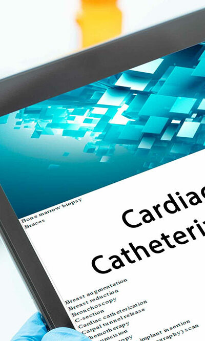 Everything to Know About Heart Catheterization Procedure